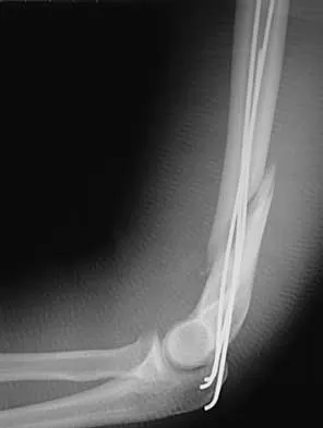 General Orthopedics 2026 Practice Questions: Set 13 (Solved) - Figure 41