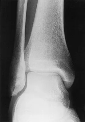 General Orthopedics 2026 Practice Questions: Set 13 (Solved) - Figure 43