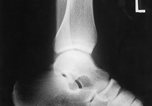 General Orthopedics 2026 Practice Questions: Set 13 (Solved) - Figure 44