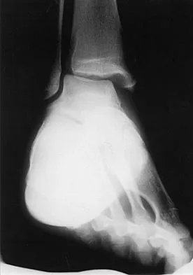 General Orthopedics 2026 Practice Questions: Set 13 (Solved) - Figure 45