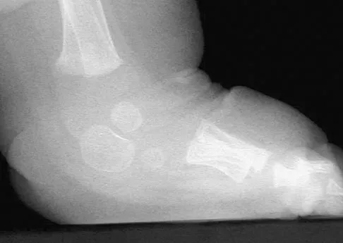 General Orthopedics 2026 Practice Questions: Set 13 (Solved) - Figure 46