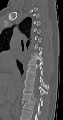 General Orthopedics 2026 Practice Questions: Set 13 (Solved) - Figure 5