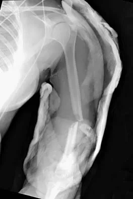 General Orthopedics 2026 Practice Questions: Set 13 (Solved) - Figure 52