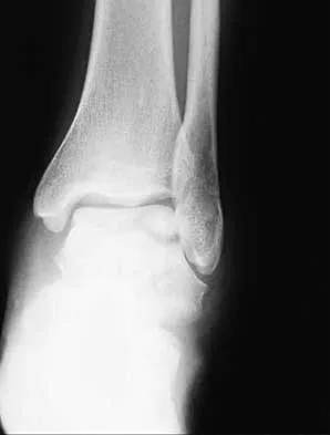 General Orthopedics 2026 Practice Questions: Set 13 (Solved) - Figure 56