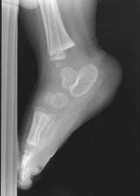 General Orthopedics 2026 Practice Questions: Set 13 (Solved) - Figure 61