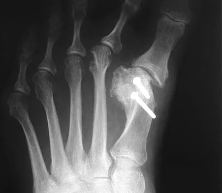 General Orthopedics 2026 Practice Questions: Set 13 (Solved) - Figure 65