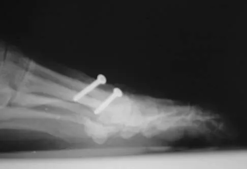 General Orthopedics 2026 Practice Questions: Set 13 (Solved) - Figure 66