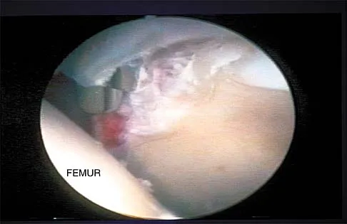 General Orthopedics 2026 Practice Questions: Set 13 (Solved) - Figure 67