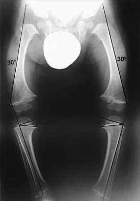 General Orthopedics 2026 Practice Questions: Set 13 (Solved) - Figure 74