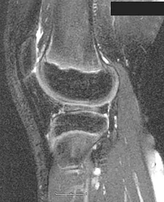 General Orthopedics 2026 Practice Questions: Set 13 (Solved) - Figure 77