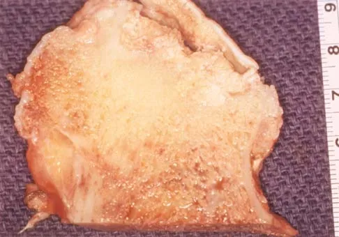 General Orthopedics 2026 Practice Questions: Set 13 (Solved) - Figure 8