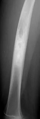 General Orthopedics 2026 Practice Questions: Set 13 (Solved) - Figure 80