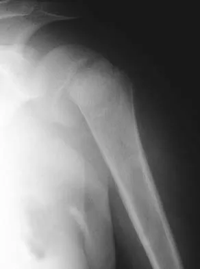 General Orthopedics 2026 Practice Questions: Set 13 (Solved) - Figure 82