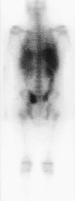 General Orthopedics 2026 Practice Questions: Set 13 (Solved) - Figure 86