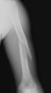 General Orthopedics 2026 Practice Questions: Set 13 (Solved) - Figure 88