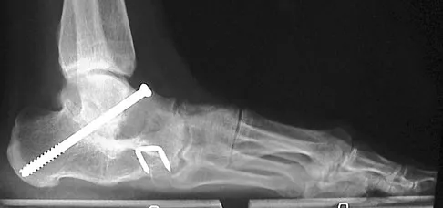 General Orthopedics 2026 Practice Questions: Set 13 (Solved) - Figure 90