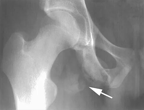 General Orthopedics Board Review 2026: High-Yield MCQs (Set 14) - Figure 1