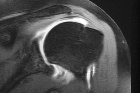 General Orthopedics Board Review 2026: High-Yield MCQs (Set 14) - Figure 2