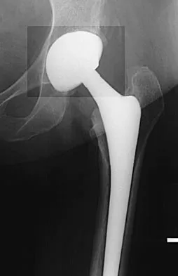 General Orthopedics Board Review 2026: High-Yield MCQs (Set 14) - Figure 24