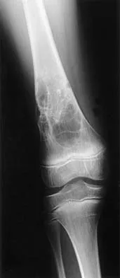 General Orthopedics Board Review 2026: High-Yield MCQs (Set 14) - Figure 27