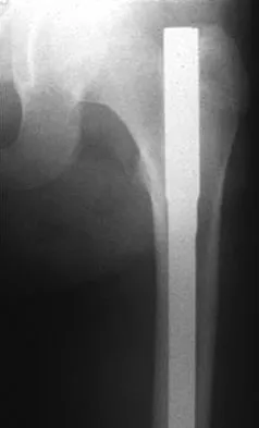 General Orthopedics Board Review 2026: High-Yield MCQs (Set 14) - Figure 29