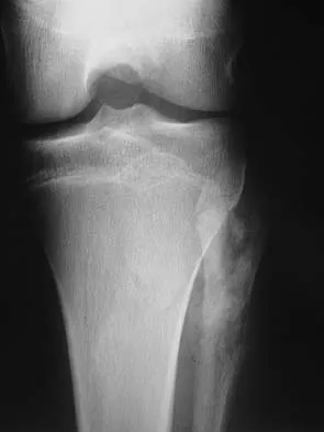 General Orthopedics Board Review 2026: High-Yield MCQs (Set 14) - Figure 32