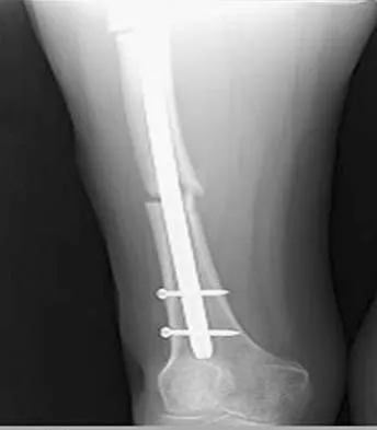 General Orthopedics Board Review 2026: High-Yield MCQs (Set 14) - Figure 37