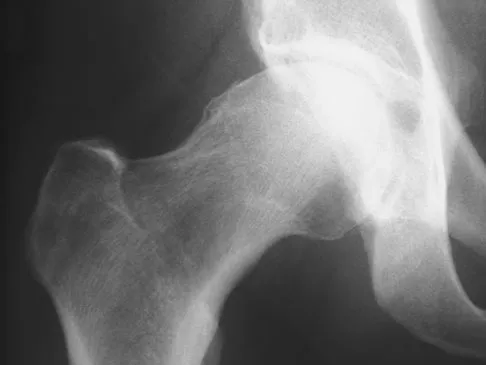 General Orthopedics Board Review 2026: High-Yield MCQs (Set 14) - Figure 46