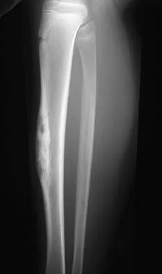 General Orthopedics Board Review 2026: High-Yield MCQs (Set 14) - Figure 52