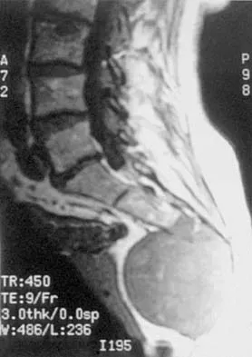 General Orthopedics Board Review 2026: High-Yield MCQs (Set 14) - Figure 60