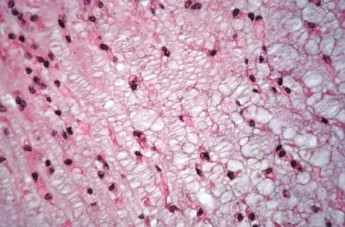 General Orthopedics Board Review 2026: High-Yield MCQs (Set 14) - Figure 61