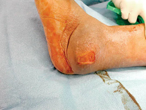 General Orthopedics Board Review 2026: High-Yield MCQs (Set 14) - Figure 65