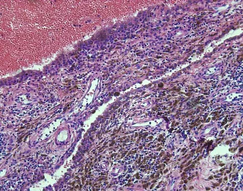 General Orthopedics Board Review 2026: High-Yield MCQs (Set 14) - Figure 7