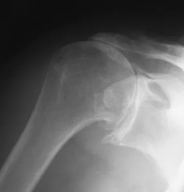 General Orthopedics Board Review 2026: High-Yield MCQs (Set 14) - Figure 70