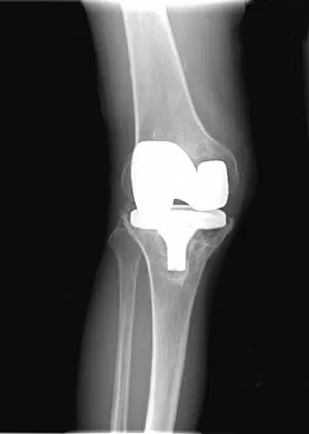 General Orthopedics Board Review 2026: High-Yield MCQs (Set 14) - Figure 72