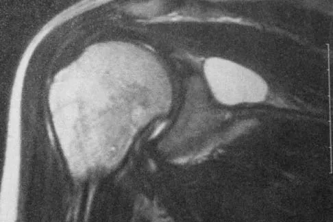 General Orthopedics Board Review 2026: High-Yield MCQs (Set 14) - Figure 82