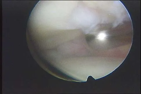 General Orthopedics Board Review 2026: High-Yield MCQs (Set 14) - Figure 83