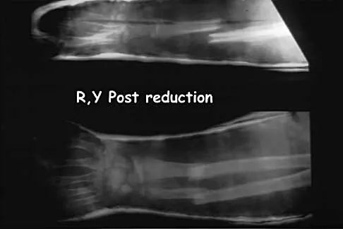 General Orthopedics Board Review 2026: High-Yield MCQs (Set 14) - Figure 93