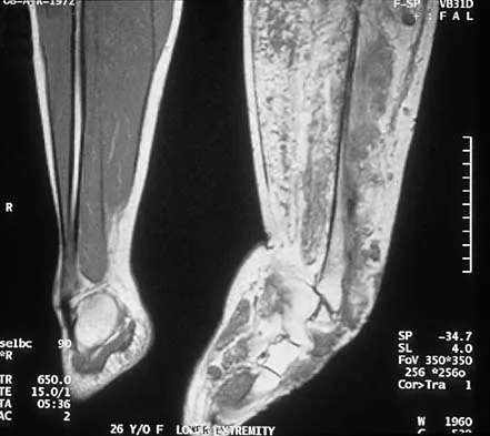 General Orthopedics Board Review 2026: High-Yield MCQs (Set 14) - Figure 96