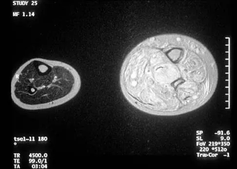 General Orthopedics Board Review 2026: High-Yield MCQs (Set 14) - Figure 97
