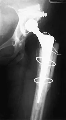 General Orthopedics Board Review 2026: High-Yield MCQs (Set 14) - Figure 98