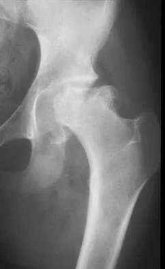 General Orthopedics 2026 Practice Questions: Set 15 (Solved) - Figure 1