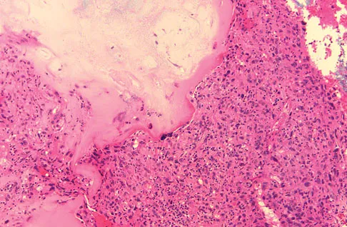 General Orthopedics 2026 Practice Questions: Set 15 (Solved) - Figure 10
