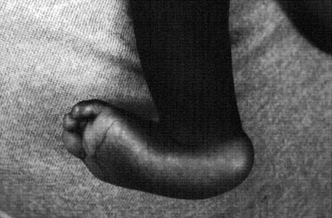 General Orthopedics 2026 Practice Questions: Set 15 (Solved) - Figure 101