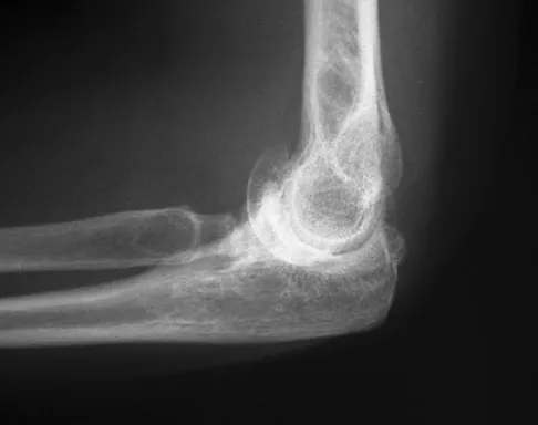 General Orthopedics 2026 Practice Questions: Set 15 (Solved) - Figure 108