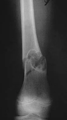 General Orthopedics 2026 Practice Questions: Set 15 (Solved) - Figure 112