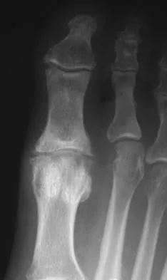 General Orthopedics 2026 Practice Questions: Set 15 (Solved) - Figure 115