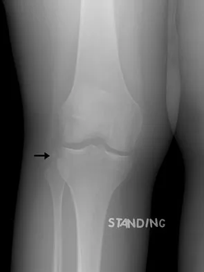 General Orthopedics 2026 Practice Questions: Set 15 (Solved) - Figure 116