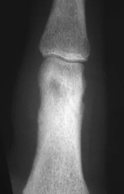 General Orthopedics 2026 Practice Questions: Set 15 (Solved) - Figure 119