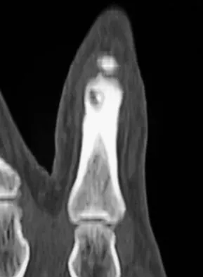 General Orthopedics 2026 Practice Questions: Set 15 (Solved) - Figure 120